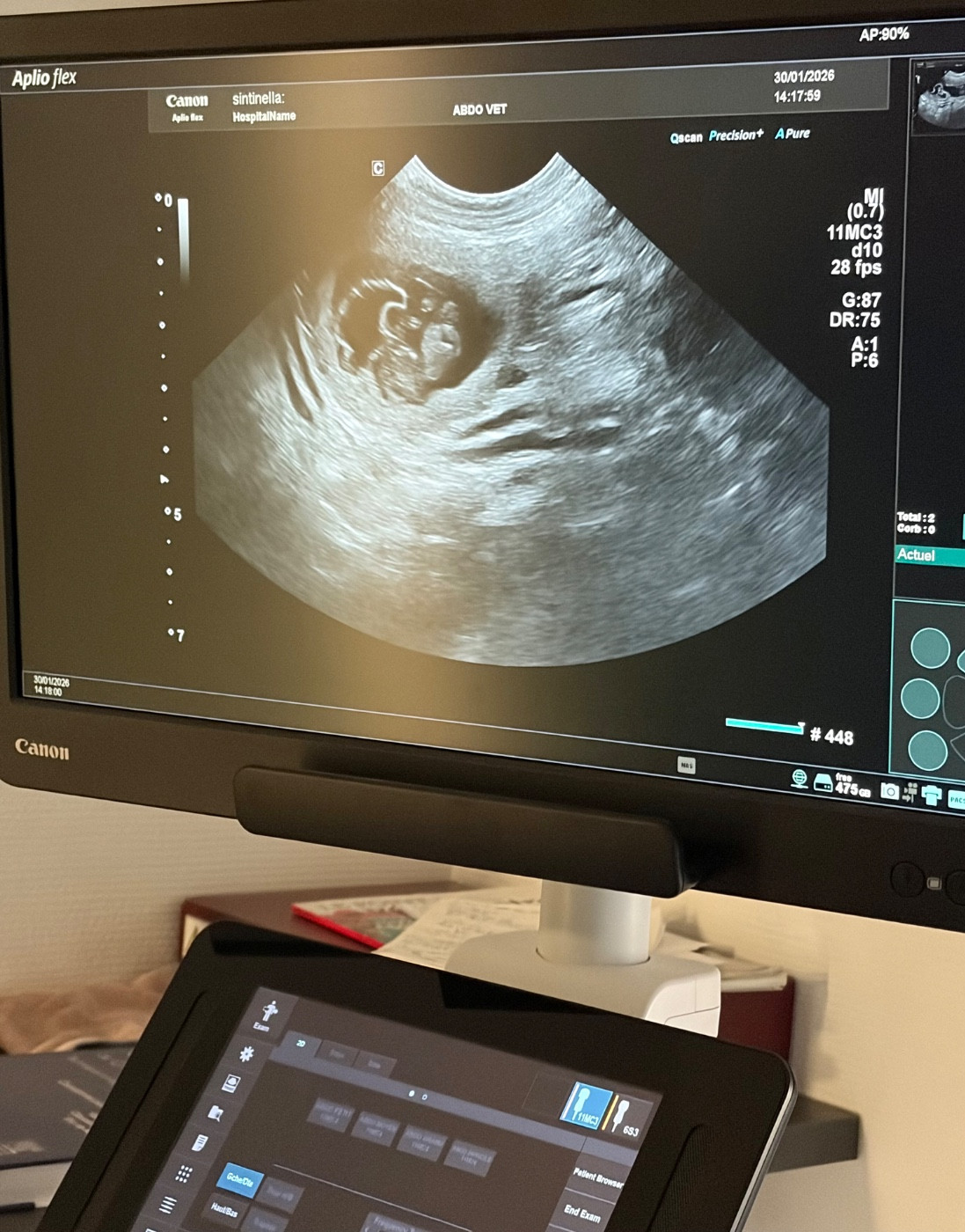 Gestation confirmée pour Sintinella